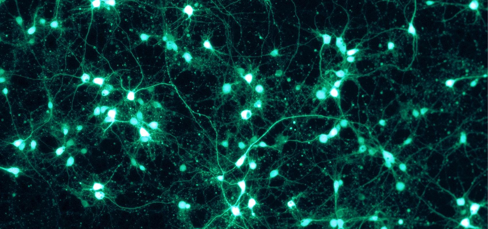 Neurones cultivés in vitro exprimant la protéine fluorescente verte -  - ManuelSchottdorf CC BY-SA 4.0 / via Wikimedia Commons