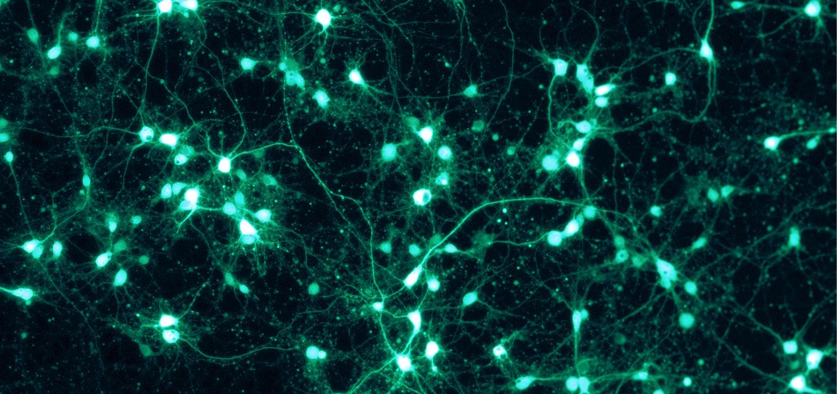 Neurones cultivés in vitro exprimant la protéine fluorescente verte - - ManuelSchottdorf CC BY-SA 4.0 / via Wikimedia Commons