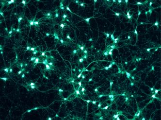 Neurones cultivés in vitro exprimant la protéine fluorescente verte